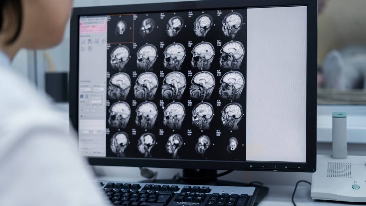 Bridgeport Traumatic Brain Injury Attorney