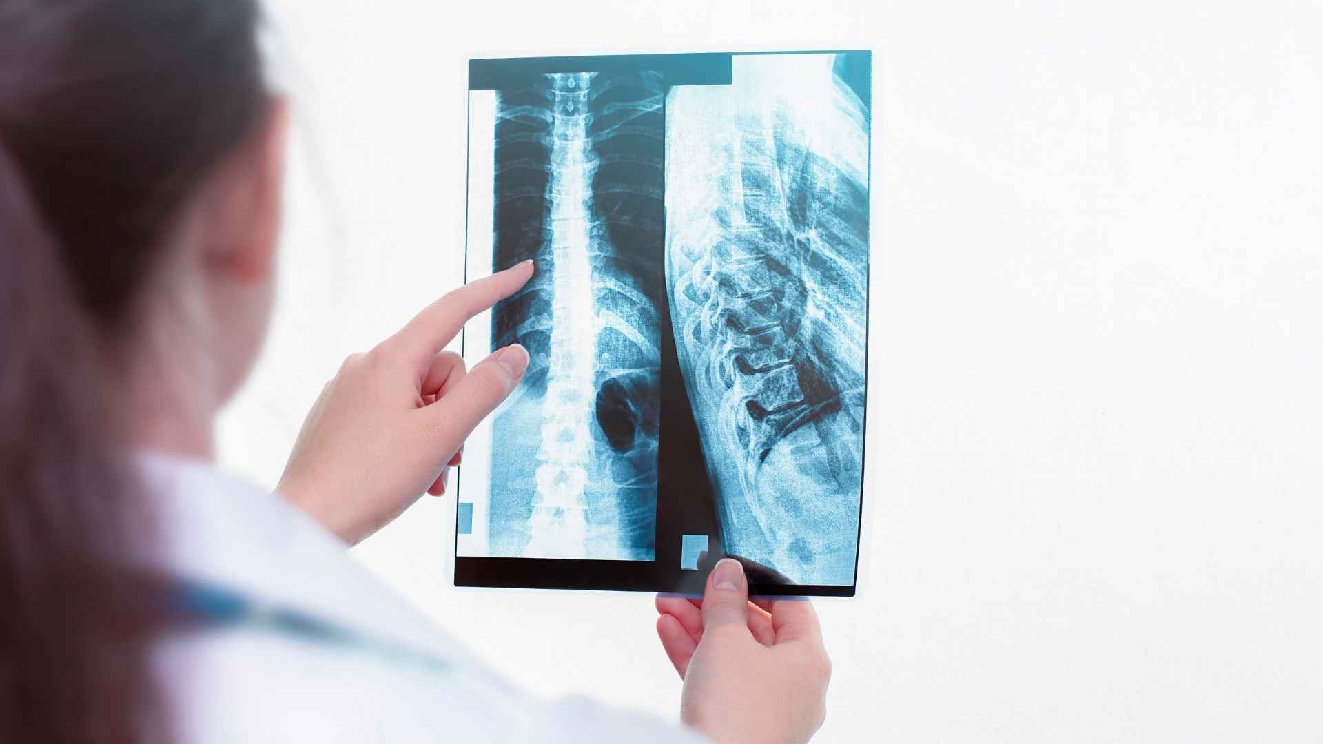 Long Island Spinal Cord Injury Attorney