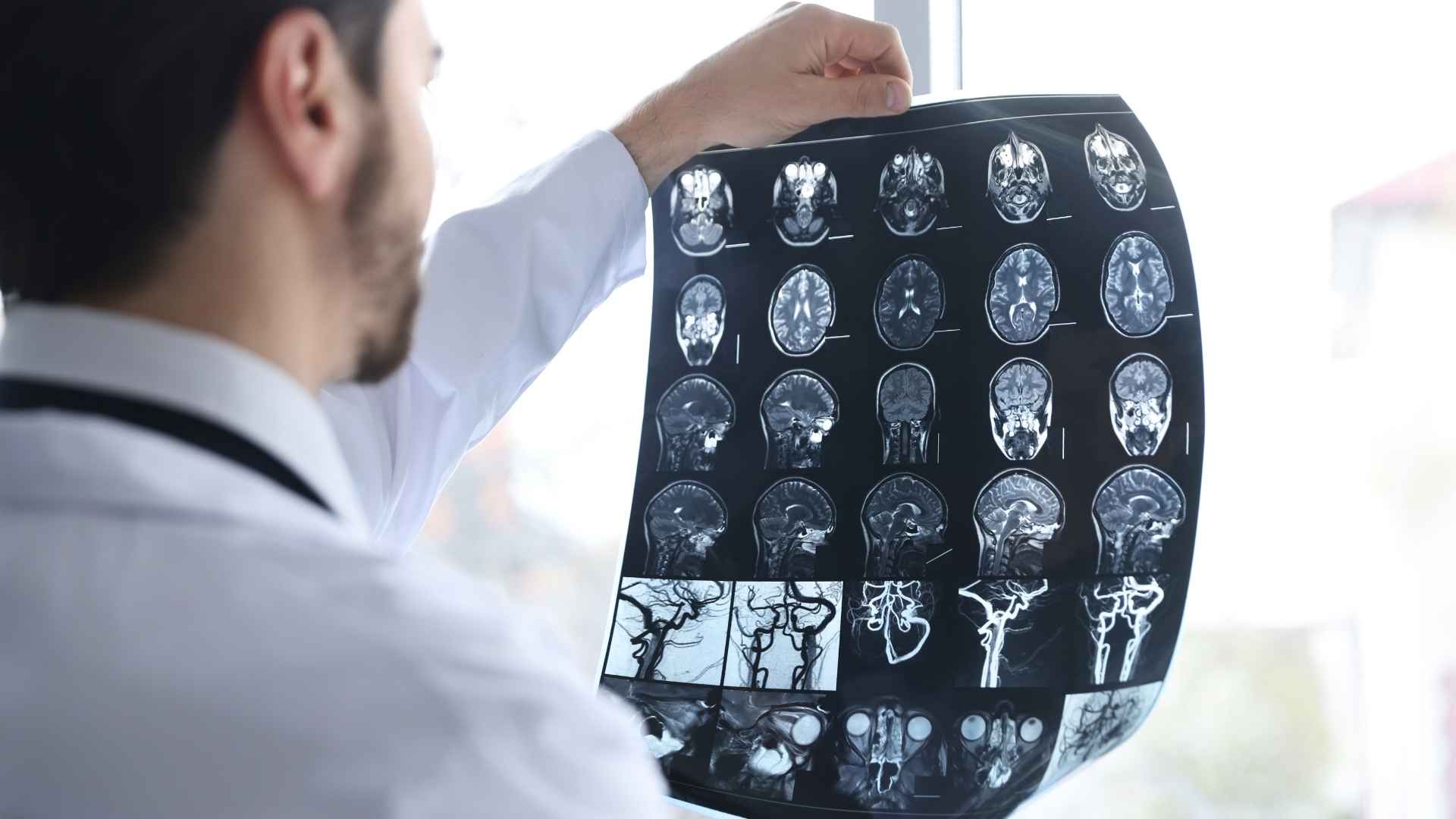 Chicopee Traumatic Brain Injury Attorney